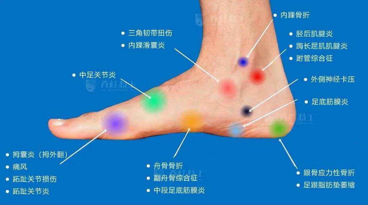 脚上各个部位名称分别是什么